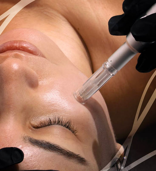 Why Microneedling Is the Most Underrated Anti-Aging Treatment