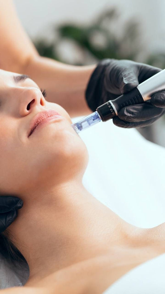 Microneedling 3 pack